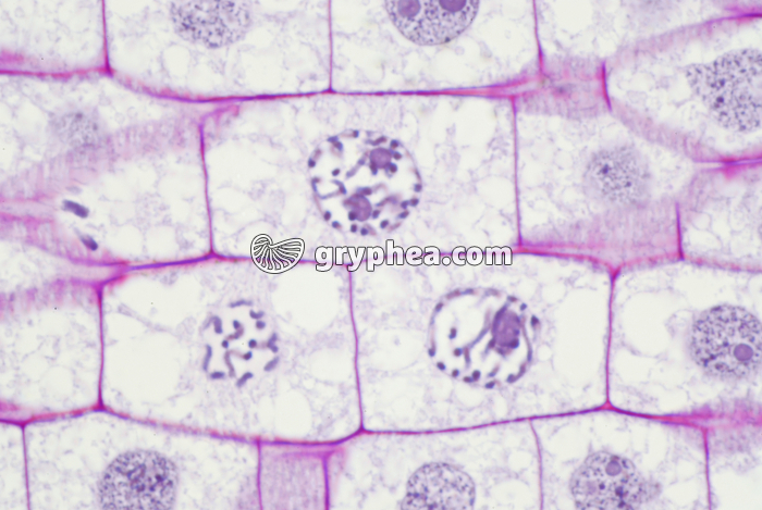 Mitose dans une racine de Blé (prophases) x400 - gryphea.org